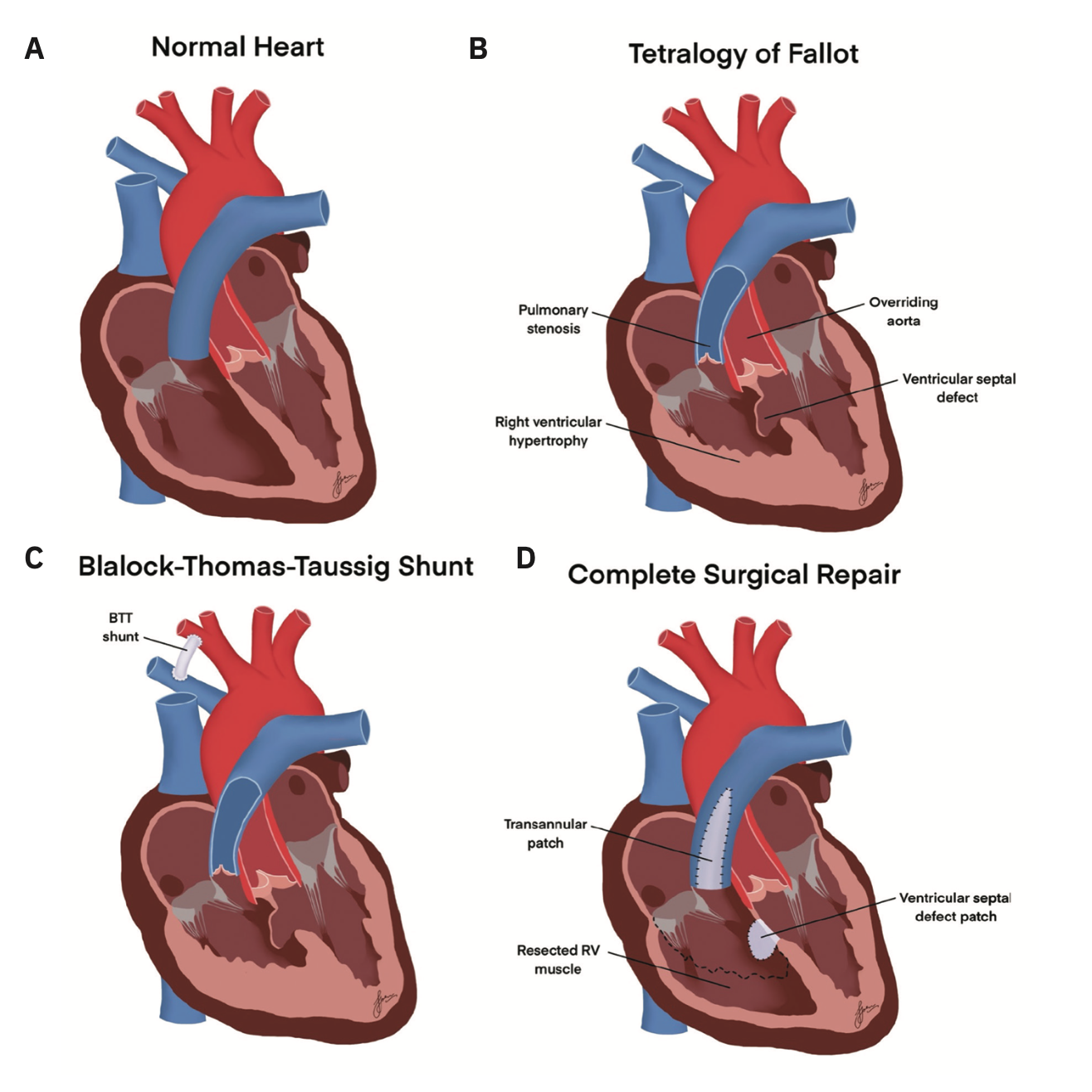 Home cathlab